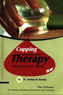 Cupping Therapy- The Ancient Art of Healing( Pocket Size)