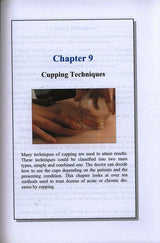 Cupping The Great Missing Therapy